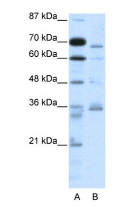PCSK6 antibody