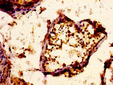 PCSK6 Antibody