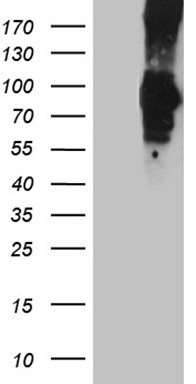 PCSK9 antibody