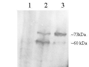Goat anti-PCSK9 (C Terminus) Antibody