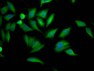 PCYT1A Recombinant Monoclonal Antibody