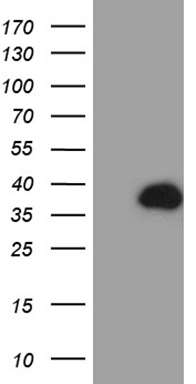 PD L2 (PDCD1LG2) antibody