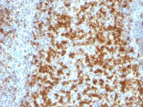 PD1 antibody