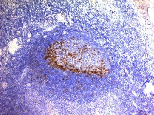 PDCD1 / PD1 / CD279 (Programmed Cell Death 1) Antibody