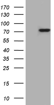 PD1 (PDCD1) antibody