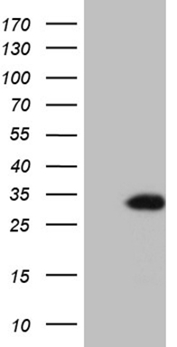 PD1 (PDCD1) antibody