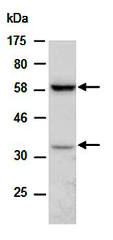PD1 antibody