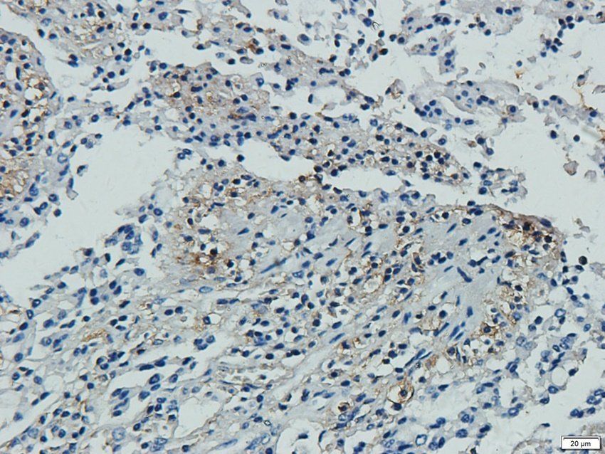 PD2R2 antibody