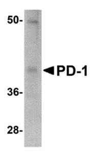 PD Monoclonal Antibody