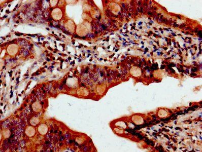 PDCD10 Antibody