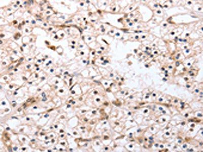 PDCD10 Antibody
