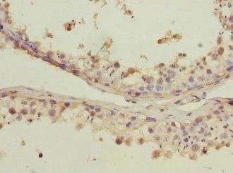 PDCD5 Antibody