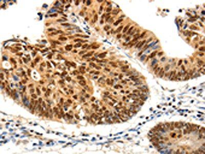 PDCD6 Antibody