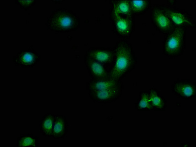 PDCL3 antibody