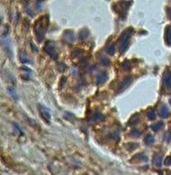 PDCL3 Rabbit Polyclonal Antibody