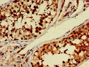 PDE11A Antibody