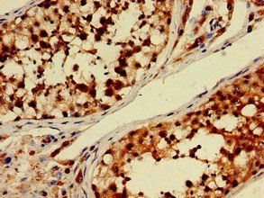 PDE11A antibody