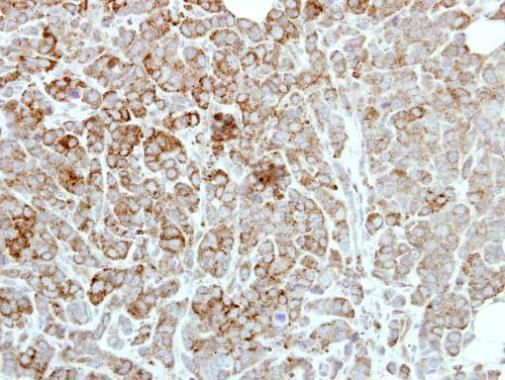 PDE1A antibody