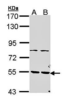 PDE1A antibody