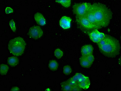 PDE1B antibody