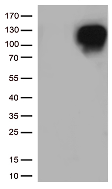PDE3B antibody