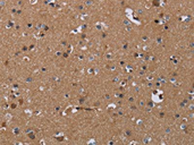 PDE4A Antibody