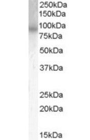 PDE4B antibody