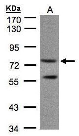 PDE4C Rabbit Polyclonal Antibody