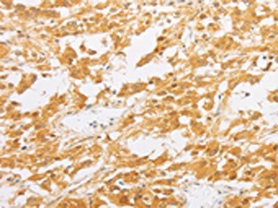 PDE4D Antibody