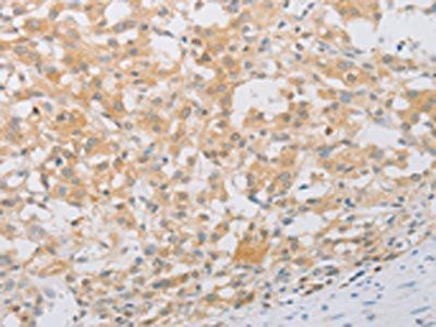 PDE4D Antibody