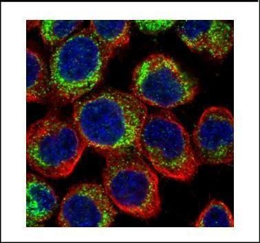 PDE4D antibody [C3], C-term