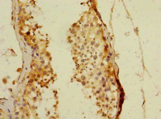 PDE4DIP Antibody