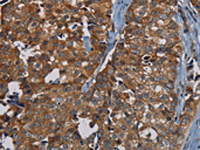 PDE5A Antibody