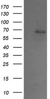 PDE6 gamma (PDE6G) antibody