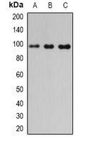 PDE6B antibody