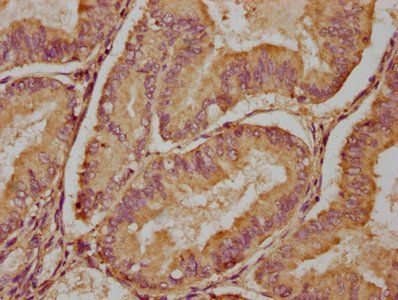 PDE6H Antibody