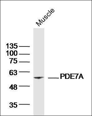 PDE7A antibody