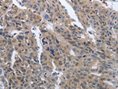 PDGFB Antibody