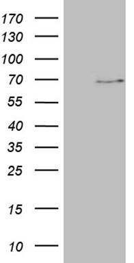 PDGF Receptor alpha (PDGFRA) antibody