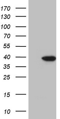 PDGF Receptor alpha (PDGFRA) antibody