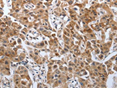 PDGFA Antibody