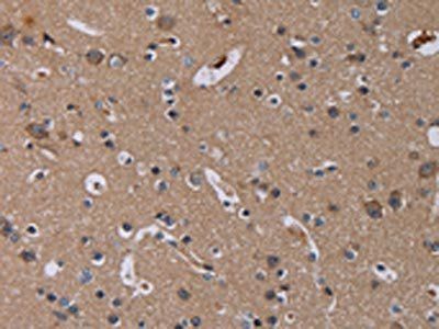 PDGFC Antibody