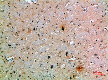 PDGFC Antibody