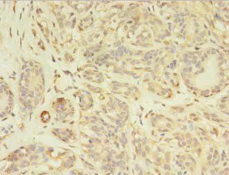 PDGFRB Antibody