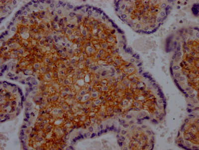 PDGFRB Recombinant Monoclonal Antibody