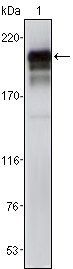 PDGFR Antibody