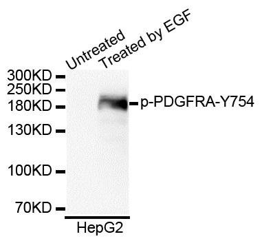 PDGFRA (phospho-Y754) antibody