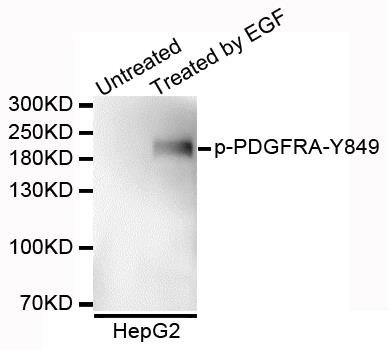 PDGFRA (Phospho-Y849) antibody