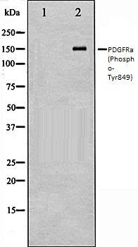 PDGFR alpha (Phospho-Tyr849) antibody