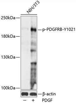 PDGFRB (Phospho-Y1021) antibody